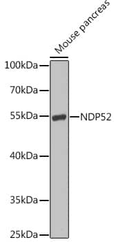 Western Blot: NDP52 Antibody [NBP3-38417] - Western blot analysis of lysates from mouse pancreas, using NDP52 Rabbit pAb at 1:1000 dilution.Secondary antibody: HRP-conjugated Goat anti-Rabbit IgG (H+L) at 1:10000 dilution.Lysates/proteins: 25ug per lane.Blocking buffer: 3% nonfat dry milk in TBST.Detection: ECL Enhanced Kit.Exposure time: 90s.