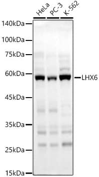 Western Blot: LHX6 Antibody [NBP3-38418] - Western blot analysis of various lysates, using LHX6 Rabbit pAb at 1:2000 dilution.Secondary antibody: HRP-conjugated Goat anti-Rabbit IgG (H+L) at 1:10000 dilution.Lysates/proteins: 25ug per lane.Blocking buffer: 3% nonfat dry milk in TBST.Detection: ECL Basic Kit.Exposure time: 30s.