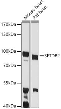 Western Blot: SETDB2 Antibody [NBP3-38422] - Western blot analysis of various lysates using SETDB2 Rabbit pAb at 1:1000 dilution.Secondary antibody: HRP-conjugated Goat anti-Rabbit IgG (H+L) at 1:10000 dilution.Lysates/proteins: 25ug per lane.Blocking buffer: 3% nonfat dry milk in TBST.Detection: ECL Basic Kit.Exposure time: 90s.