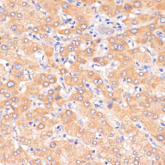 Immunohistochemistry: PDCD2L Antibody [NBP3-38423] - Immunohistochemistry analysis of paraffin-embedded Human liver using PDCD2L Rabbit pAb at dilution of 1:100 (40x lens). Microwave antigen retrieval performed with 0.01M PBS Buffer (pH 7.2) prior to IHC staining.