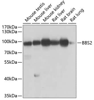 Western Blot: BBS2 Antibody [NBP3-38426] - Western blot analysis of various lysates using BBS2 Rabbit pAb at 1:1000 dilution.Secondary antibody: HRP-conjugated Goat anti-Rabbit IgG (H+L) at 1:10000 dilution.Lysates/proteins: 25ug per lane.Blocking buffer: 3% nonfat dry milk in TBST.Detection: ECL Enhanced Kit.Exposure time: 5s.