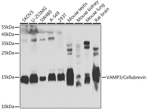 Western Blot: VAMP3/Cellubrevin Antibody [NBP3-38430] - Western blot analysis of various lysates using VAMP3/Cellubrevin Rabbit pAb at 1:1000 dilution.Secondary antibody: HRP-conjugated Goat anti-Rabbit IgG (H+L) at 1:10000 dilution.Lysates/proteins: 25ug per lane.Blocking buffer: 3% nonfat dry milk in TBST.Detection: ECL Enhanced Kit.Exposure time: 5s.