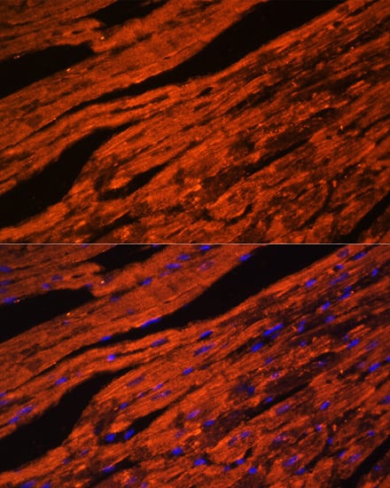 Immunocytochemistry/ Immunofluorescence: LDB3 Antibody [NBP3-38431] - Immunofluorescence analysis of paraffin-embedded mouse heart using LDB3 Rabbit pAb at dilution of 1:100. Secondary antibody: Cy3-conjugated Goat anti-Rabbit IgG (H+L) at 1:500 dilution. Blue: DAPI for nuclear staining.