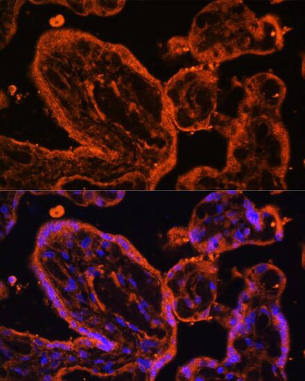 Immunocytochemistry/ Immunofluorescence: LDB3 Antibody [NBP3-38431] - Immunofluorescence analysis of paraffin-embedded human placenta using LDB3 Rabbit pAb at dilution of 1:100. Secondary antibody: Cy3-conjugated Goat anti-Rabbit IgG (H+L) at 1:500 dilution. Blue: DAPI for nuclear staining.