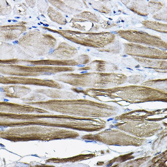 Immunohistochemistry: LDB3 Antibody [NBP3-38431] - Immunohistochemistry analysis of paraffin-embedded Mouse stomach using LDB3 Rabbit pAb at dilution of 1:200 (40x lens). High pressure antigen retrieval performed with 0.01M Citrate Bufferr (pH 6.0) prior to IHC staining.