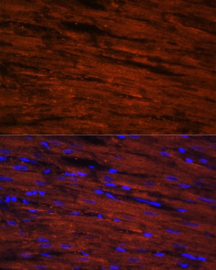 Immunocytochemistry/ Immunofluorescence: LDB3 Antibody [NBP3-38431] - Immunofluorescence analysis of paraffin-embedded rat heart using LDB3 Rabbit pAb at dilution of 1:100. Secondary antibody: Cy3-conjugated Goat anti-Rabbit IgG (H+L) at 1:500 dilution. Blue: DAPI for nuclear staining.