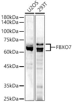 Western Blot: FBXO7 Antibody [NBP3-38432] - Western blot analysis of various lysates using FBXO7 Rabbit pAb at  1:500 dilution.Secondary antibody: HRP-conjugated Goat anti-Rabbit IgG (H+L) at 1:10000 dilution.Lysates/proteins: 25ug per lane.Blocking buffer: 3% nonfat dry milk in TBST.Detection: ECL Enhanced Kit.Exposure time: 120s.