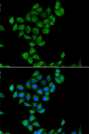 Immunocytochemistry/ Immunofluorescence: COQ3 Antibody [NBP3-38433] - Immunofluorescence analysis of A549 cells using COQ3 Rabbit pAb. Secondary antibody: Cy3-conjugated Goat anti-Rabbit IgG (H+L) at 1:500 dilution. Blue: DAPI for nuclear staining.