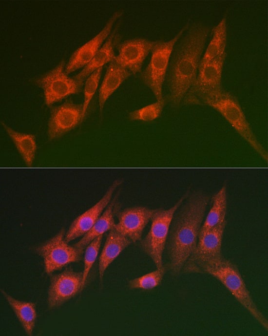 Immunocytochemistry/ Immunofluorescence: MTMR14 Antibody [NBP3-38434] - Immunofluorescence analysis of NIH/3T3 cells using MTMR14 Rabbit pAb at dilution of 1:100 (40x lens). Secondary antibody: Cy3-conjugated Goat anti-Rabbit IgG (H+L) at 1:500 dilution. Blue: DAPI for nuclear staining.