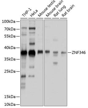 Western Blot: ZNF346 Antibody [NBP3-38437] - Western Blot analysis of various lysates using ZNF346 Rabbit pAb at 1:1000 dilution.Secondary antibody: HRP-conjugated Goat anti-Rabbit IgG (H+L) at 1:10000 dilution.Lysates/proteins: 25ug per lane.Blocking buffer: 3% nonfat dry milk in TBST.Detection: ECL Enhanced Kit (RM00021).Exposure time: 1s.