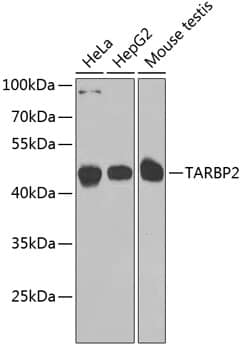 Western Blot: TRBP Antibody [NBP3-38439] - Western blot analysis of various lysates using TRBP Rabbit pAb at 1:1000 dilution.Secondary antibody: HRP-conjugated Goat anti-Rabbit IgG (H+L) at 1:10000 dilution.Lysates/proteins: 25ug per lane.Blocking buffer: 3% nonfat dry milk in TBST.Detection: ECL Basic Kit.Exposure time: 90s.