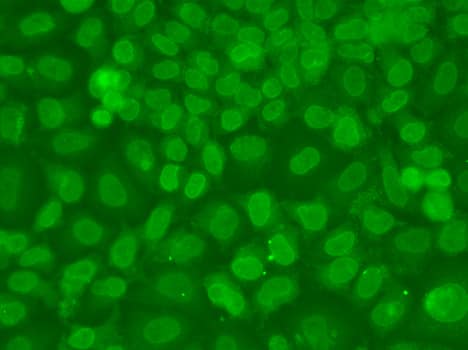 Immunocytochemistry/ Immunofluorescence: TRBP Antibody [NBP3-38439] - Immunofluorescence analysis of A549 cells using TRBP Rabbit pAb.Secondary antibody: Cy3-conjugated Goat anti-Rabbit IgG (H+L) at 1:500 dilution.