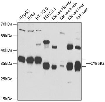 Western Blot: CYB5R3 Antibody [NBP3-38440] - Western blot analysis of various lysates using CYB5R3 Rabbit pAb at 1:1000 dilution.Secondary antibody: HRP-conjugated Goat anti-Rabbit IgG (H+L) at 1:10000 dilution.Lysates/proteins: 25ug per lane.Blocking buffer: 3% nonfat dry milk in TBST.Detection: ECL Basic Kit.Exposure time: 1s.