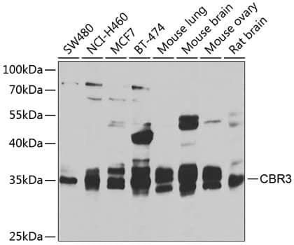 Western Blot: CBR3 Antibody [NBP3-38441] - Western blot analysis of various lysates using CBR3 Rabbit pAb at 1:1000 dilution.Secondary antibody: HRP-conjugated Goat anti-Rabbit IgG (H+L) at 1:10000 dilution.Lysates/proteins: 25ug per lane.Blocking buffer: 3% nonfat dry milk in TBST.Detection: ECL Basic Kit.Exposure time: 30s.