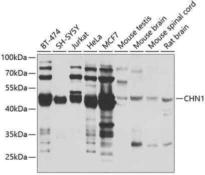 Western Blot: CHN 1 Antibody [NBP3-38442] - Western blot analysis of various lysates using CHN 1 Rabbit pAb at 1:1000 dilution.Secondary antibody: HRP-conjugated Goat anti-Rabbit IgG (H+L) at 1:10000 dilution.Lysates/proteins: 25ug per lane.Blocking buffer: 3% nonfat dry milk in TBST.Detection: ECL Basic Kit.Exposure time: 5s.