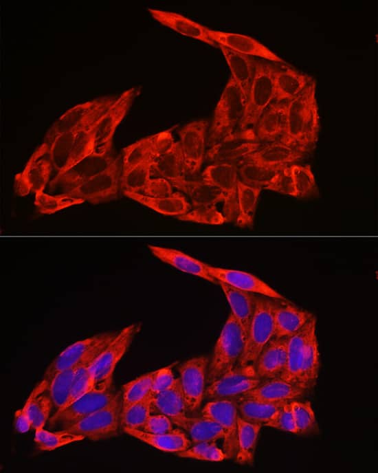 Immunocytochemistry/ Immunofluorescence NRAS Antibody