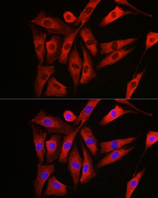 Immunocytochemistry/ Immunofluorescence: NRAS Antibody [NBP3-38443] - Immunofluorescence analysis of NIH/3T3 cells using NRAS Rabbit pAb at dilution of 1:100 (40x lens). Secondary antibody: Cy3-conjugated Goat anti-Rabbit IgG (H+L) at 1:500 dilution. Blue: DAPI for nuclear staining.