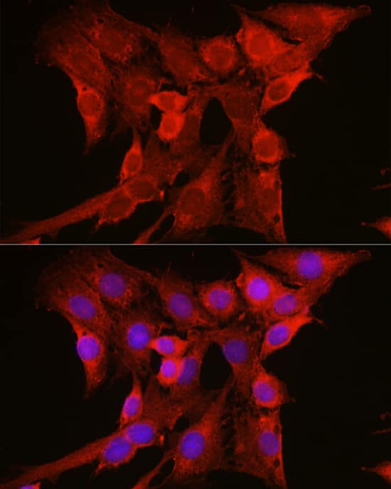 Immunocytochemistry/ Immunofluorescence: NRAS Antibody [NBP3-38443] - Immunofluorescence analysis of C6 cells using NRAS Rabbit pAb at dilution of 1:100 (40x lens). Secondary antibody: Cy3-conjugated Goat anti-Rabbit IgG (H+L) at 1:500 dilution. Blue: DAPI for nuclear staining.