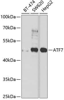 Western Blot: ATF7 Antibody [NBP3-38445] - Western blot analysis of various lysates using ATF7 Rabbit pAb at 1:1000 dilution.Secondary antibody: HRP-conjugated Goat anti-Rabbit IgG (H+L) at 1:10000 dilution.Lysates/proteins: 25ug per lane.Blocking buffer: 3% nonfat dry milk in TBST.Detection: ECL Basic Kit.Exposure time: 90s.