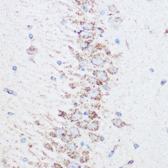 Immunohistochemistry: SIRT4 Antibody [NBP3-38446] - Immunohistochemistry analysis of paraffin-embedded Rat brain using SIRT4 Rabbit pAb at dilution of 1:100 (40x lens). Microwave antigen retrieval performed with 0.01M Tris/EDTA Buffer (pH 9.0) prior to IHC staining.