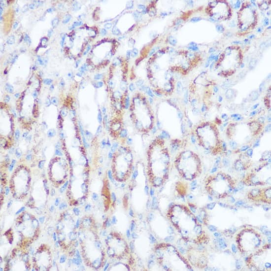 Immunohistochemistry: SIRT4 Antibody [NBP3-38446] - Immunohistochemistry analysis of paraffin-embedded Mouse kidney using SIRT4 Rabbit pAb at dilution of 1:100 (40x lens). Microwave antigen retrieval performed with 0.01M Tris/EDTA Buffer (pH 9.0) prior to IHC staining.