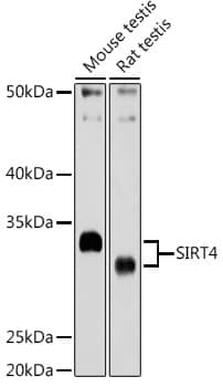 Western Blot: SIRT4 Antibody [NBP3-38446] - Western blot analysis of various lysates using SIRT4 Rabbit pAb at 1:1000 dilution.Secondary antibody: HRP-conjugated Goat anti-Rabbit IgG (H+L) at 1:10000 dilution.Lysates/proteins: 25ug per lane.Blocking buffer: 3% nonfat dry milk in TBST.Detection: ECL Basic Kit.Exposure time: 180s.