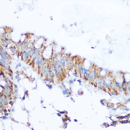 Immunohistochemistry: SIRT4 Antibody [NBP3-38446] - Immunohistochemistry analysis of paraffin-embedded Human colon using SIRT4 Rabbit pAb at dilution of 1:100 (40x lens). Microwave antigen retrieval performed with 0.01M Tris/EDTA Buffer (pH 9.0) prior to IHC staining.