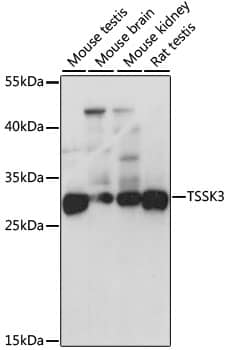 Western Blot: STK22C Antibody [NBP3-38448] - Western blot analysis of various lysates using STK22C Rabbit pAb at 1:1000 dilution.Secondary antibody: HRP-conjugated Goat anti-Rabbit IgG (H+L) at 1:10000 dilution.Lysates/proteins: 25ug per lane.Blocking buffer: 3% nonfat dry milk in TBST.Detection: ECL Basic Kit.Exposure time: 1s.