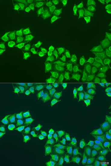 Immunocytochemistry/ Immunofluorescence: ATP5F1 Antibody [NBP3-38449] - Immunofluorescence analysis of U2OS cells using ATP5F1 Rabbit pAb at dilution of 1:100. Secondary antibody: Cy3-conjugated Goat anti-Rabbit IgG (H+L) at 1:500 dilution. Blue: DAPI for nuclear staining.