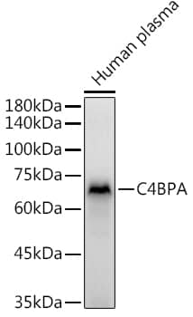 Western Blot: C4 binding protein A Antibody [NBP3-38450] - Western blot analysis of lysates from Human plasma, using C4 binding protein A Rabbit pAb at 1:3000 dilution.Secondary antibody: HRP-conjugated Goat anti-Rabbit IgG (H+L) at 1:10000 dilution.Lysates/proteins: 25ug per lane.Blocking buffer: 3% nonfat dry milk in TBST.Detection: ECL Basic Kit.Exposure time: 5s.