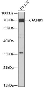 Western Blot: CACNB1 Antibody [NBP3-38451] - Western blot analysis of lysates from HepG2 cells, using CACNB1 Rabbit pAb at 1:1000 dilution.Secondary antibody: HRP-conjugated Goat anti-Rabbit IgG (H+L) at 1:10000 dilution.Lysates/proteins: 25ug per lane.Blocking buffer: 3% nonfat dry milk in TBST.Detection: ECL Basic Kit.Exposure time: 30s.