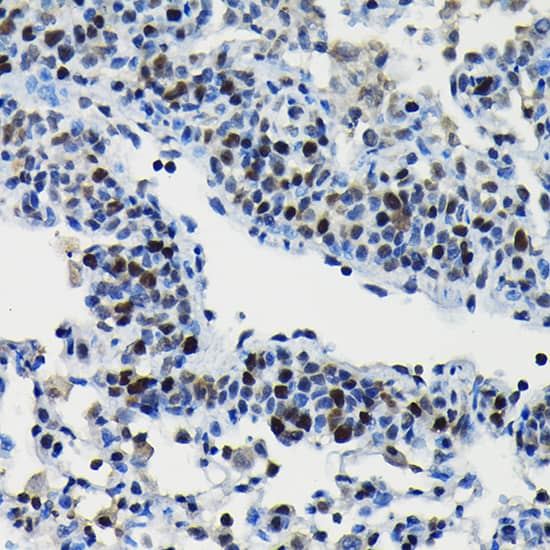 Immunohistochemistry: DRIL1 Antibody [NBP3-38452] - Immunohistochemistry analysis of paraffin-embedded Rat lung using DRIL1 Rabbit pAb at dilution of 1:100 (40x lens). High pressure antigen retrieval performed with 0.01M Citrate Bufferr (pH 6.0) prior to IHC staining.