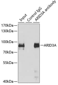 Immunoprecipitation: DRIL1 Antibody [NBP3-38452] - Immunoprecipitation analysis of 150 ug extracts of MCF7 cells using 3 ug DRIL1 antibody. Western blot was performed from the immunoprecipitate using DRIL1 antibody at a dilution of 1:500.