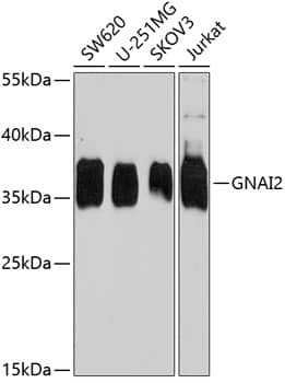 Western Blot: G protein alpha Inhibitor 2 Antibody [NBP3-38453] - Western blot analysis of various lysates using G protein alpha Inhibitor 2 Rabbit pAb at 1:1000 dilution.Secondary antibody: HRP-conjugated Goat anti-Rabbit IgG (H+L) at 1:10000 dilution.Lysates/proteins: 25ug per lane.Blocking buffer: 3% nonfat dry milk in TBST.Detection: ECL Enhanced Kit.Exposure time: 5s.