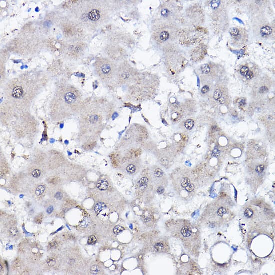 Immunohistochemistry: HspA6 Antibody [NBP3-38454] - Immunohistochemistry analysis of paraffin-embedded Human liver using HspA6 Rabbit pAb at dilution of 1:100 (40x lens). High pressure antigen retrieval performed with 0.01M Citrate Bufferr (pH 6.0) prior to IHC staining.