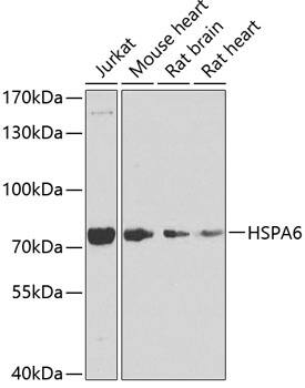 Western Blot: HspA6 Antibody [NBP3-38454] - Western blot analysis of various lysates using HspA6 Rabbit pAb at 1:1000 dilution.Secondary antibody: HRP-conjugated Goat anti-Rabbit IgG (H+L) at 1:10000 dilution.Lysates/proteins: 25ug per lane.Blocking buffer: 3% nonfat dry milk in TBST.Detection: ECL Basic Kit.Exposure time: 30s.