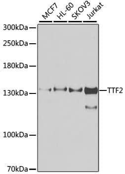 Western Blot: TTF2 Antibody [NBP3-38460] - Western blot analysis of various lysates using TTF2 Rabbit pAb at 1:1000 dilution.Secondary antibody: HRP-conjugated Goat anti-Rabbit IgG (H+L) at 1:10000 dilution.Lysates/proteins: 25ug per lane.Blocking buffer: 3% nonfat dry milk in TBST.Detection: ECL Enhanced Kit.Exposure time: 30s.