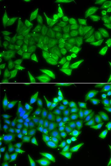 Immunocytochemistry/ Immunofluorescence: TTF2 Antibody [NBP3-38460] - Immunofluorescence analysis of A549 cells using TTF2 Rabbit pAb. Secondary antibody: Cy3-conjugated Goat anti-Rabbit IgG (H+L) at 1:500 dilution. Blue: DAPI for nuclear staining.