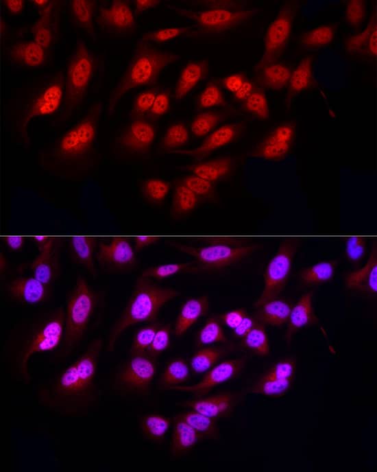 Immunocytochemistry/ Immunofluorescence FBXW11 Antibody