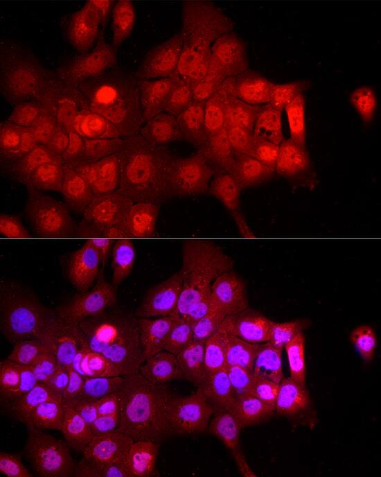 Immunocytochemistry/ Immunofluorescence: FBXW11 Antibody [NBP3-38464] - Immunofluorescence analysis of A-431 cells using FBXW11 Rabbit pAb at dilution of 1:200 (40x lens). Secondary antibody: Cy3-conjugated Goat anti-Rabbit IgG (H+L) at 1:500 dilution. Blue: DAPI for nuclear staining.