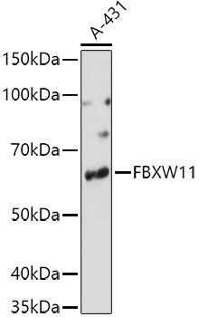 Western Blot: FBXW11 Antibody [NBP3-38464] - Western blot analysis of lysates from A-431 cells, using FBXW11 Rabbit pAb at 1:1000 dilution.&lt;br/&gt;Secondary antibody: HRP-conjugated Goat anti-Rabbit IgG (H+L) at 1:10000 dilution.&lt;br/&gt;Lysates/proteins: 25ug per lane.&lt;br/&gt;Blocking buffer: 3% nonfat dry milk in TBST.&lt;br/&gt;Detection: ECL Basic Kit.&lt;br/&gt;Exposure time: 90s.