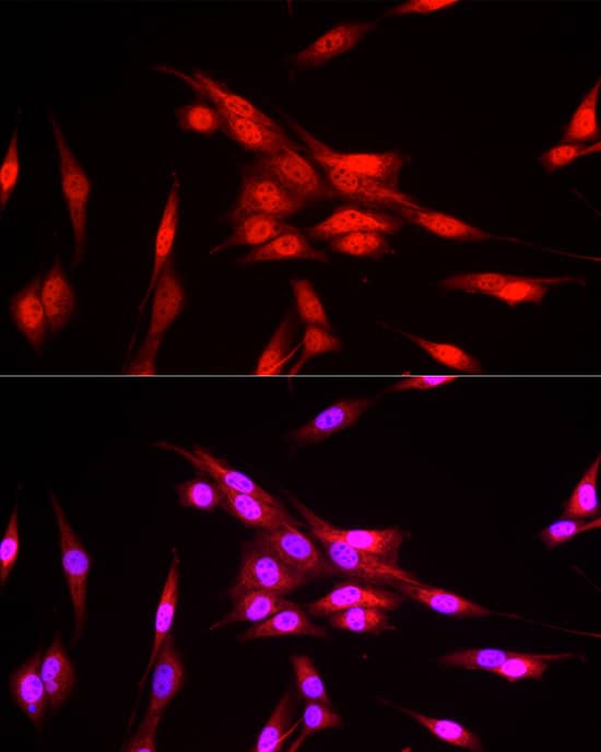 Immunocytochemistry/ Immunofluorescence: FBXW11 Antibody [NBP3-38464] - Immunofluorescence analysis of NIH/3T3 cells using FBXW11 Rabbit pAb at dilution of 1:200 (40x lens). Secondary antibody: Cy3-conjugated Goat anti-Rabbit IgG (H+L) at 1:500 dilution. Blue: DAPI for nuclear staining.