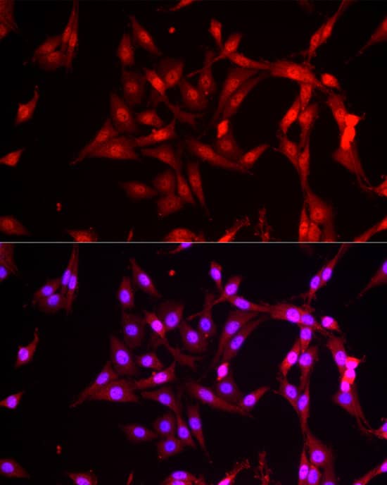 Immunocytochemistry/ Immunofluorescence: FBXW11 Antibody [NBP3-38464] - Immunofluorescence analysis of PC-12 cells using FBXW11 Rabbit pAb at dilution of 1:200 (40x lens). Secondary antibody: Cy3-conjugated Goat anti-Rabbit IgG (H+L) at 1:500 dilution. Blue: DAPI for nuclear staining.