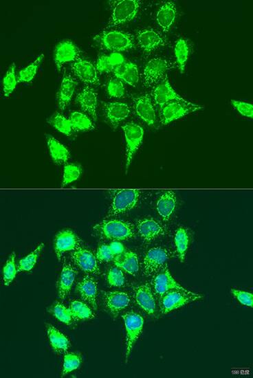 Immunocytochemistry/ Immunofluorescence: RASGRP3 Antibody [NBP3-38466] - Immunofluorescence analysis of U2OS cells using RASGRP3 Rabbit pAb at dilution of 1:100. Secondary antibody: Cy3-conjugated Goat anti-Rabbit IgG (H+L) at 1:500 dilution. Blue: DAPI for nuclear staining.