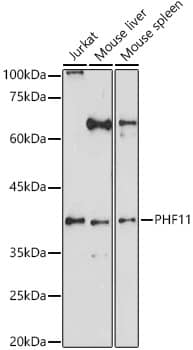 Western Blot PHF11 Antibody