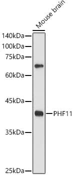 N/A PHF11 Antibody