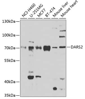 Western Blot: DARS2 Antibody [NBP3-38469] - Western blot analysis of various lysates using DARS2 Rabbit pAb at 1:1000 dilution.Secondary antibody: HRP-conjugated Goat anti-Rabbit IgG (H+L) at 1:10000 dilution.Lysates/proteins: 25ug per lane.Blocking buffer: 3% nonfat dry milk in TBST.Detection: ECL Enhanced Kit.Exposure time: 90s.