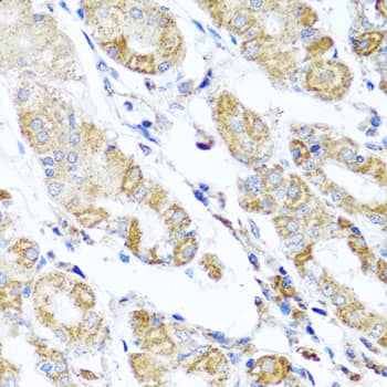 Immunohistochemistry: DARS2 Antibody [NBP3-38469] - Immunohistochemistry analysis of paraffin-embedded Human stomach using DARS2 Rabbit pAb at dilution of 1:100 (40x lens). Microwave antigen retrieval performed with 0.01M PBS Buffer (pH 7.2) prior to IHC staining.