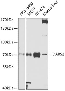 Western Blot: DARS2 Antibody [NBP3-38469] - Western blot analysis of various lysates using DARS2 Rabbit pAb at 1:1000 dilution.Secondary antibody: HRP-conjugated Goat anti-Rabbit IgG (H+L) at 1:10000 dilution.Lysates/proteins: 25ug per lane.Blocking buffer: 3% nonfat dry milk in TBST.Detection: ECL Enhanced Kit.Exposure time: 90s.