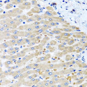 Immunohistochemistry: DARS2 Antibody [NBP3-38469] - Immunohistochemistry analysis of paraffin-embedded Human liver damage using DARS2 Rabbit pAb at dilution of 1:100 (40x lens). Microwave antigen retrieval performed with 0.01M PBS Buffer (pH 7.2) prior to IHC staining.